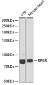 Anti-RPGR antibody used in Western Blot (WB). GTX32845