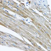Anti-RPL36 antibody used in IHC (Paraffin sections) (IHC-P). GTX32847