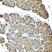 Anti-RPS14 antibody used in IHC (Paraffin sections) (IHC-P). GTX32849