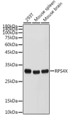 Anti-RPS4X antibody used in Western Blot (WB). GTX32850