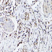 Anti-S100A4 antibody used in IHC (Paraffin sections) (IHC-P). GTX32855