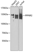 Anti-SAPS2 antibody used in Western Blot (WB). GTX32856