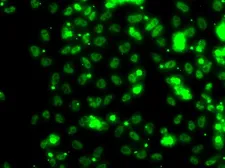 Anti-SBP2 antibody used in Immunocytochemistry/ Immunofluorescence (ICC/IF). GTX32857