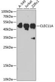 Anti-SCGF antibody used in Western Blot (WB). GTX32860