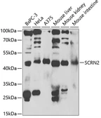 Anti-SCRN2 antibody used in Western Blot (WB). GTX32861