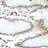 Anti-Securin antibody used in IHC (Paraffin sections) (IHC-P). GTX32862