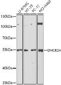 Anti-Seladin 1 antibody used in Western Blot (WB). GTX32863