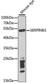 Anti-SerpinB3 antibody used in Western Blot (WB). GTX32866