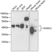 Anti-SH3GL2 antibody used in Western Blot (WB). GTX32872