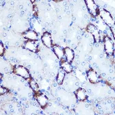 Anti-SMAD4 antibody used in IHC (Paraffin sections) (IHC-P). GTX32880