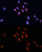 Anti-SMAD5 antibody used in Immunocytochemistry/ Immunofluorescence (ICC/IF). GTX32881