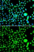 Anti-SMCHD1 antibody used in Immunocytochemistry/ Immunofluorescence (ICC/IF). GTX32883