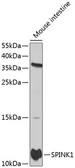 Anti-SPINK1 antibody used in Western Blot (WB). GTX32894