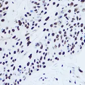 Anti-SSB antibody used in Immunocytochemistry/ Immunofluorescence (ICC/IF). GTX32896