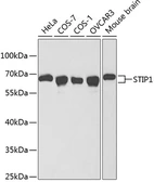 Anti-STIP1 antibody used in Western Blot (WB). GTX32900