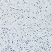Anti-TDP43 antibody used in IHC (Paraffin sections) (IHC-P). GTX32912