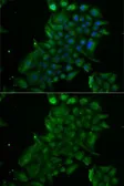 Anti-TCN1 antibody used in Immunocytochemistry/ Immunofluorescence (ICC/IF). GTX32915