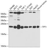 Anti-TCTP antibody used in Western Blot (WB). GTX32916