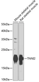 Anti-Troponin I fast skeletal muscle antibody used in Western Blot (WB). GTX32927