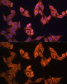Anti-TOMM20 antibody used in Immunocytochemistry/ Immunofluorescence (ICC/IF). GTX32928
