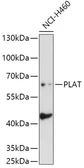 Anti-tPA antibody used in Western Blot (WB). GTX32930