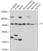 Anti-Transferrin antibody used in Western Blot (WB). GTX32933