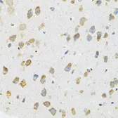 Anti-Transglutaminase 2 antibody used in IHC (Paraffin sections) (IHC-P). GTX32934