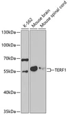 Anti-TRF1 antibody used in Western Blot (WB). GTX32935