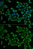 Anti-Tryptophanyl tRNA synthetase antibody used in Immunocytochemistry/ Immunofluorescence (ICC/IF). GTX32939