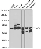 Anti-TSEN2 antibody used in Western Blot (WB). GTX32940