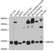 Anti-UBE2D4 antibody used in Western Blot (WB). GTX32943