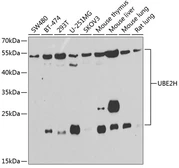 Anti-UBE2H antibody used in Western Blot (WB). GTX32944