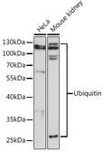 Anti-Ubiquitin B antibody used in Western Blot (WB). GTX32946
