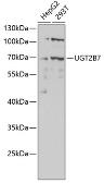 Anti-UGT2B7 antibody used in Western Blot (WB). GTX32950