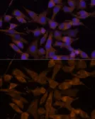 Anti-UGT2B7 antibody used in Immunocytochemistry/ Immunofluorescence (ICC/IF). GTX32950