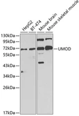 Anti-Uromucoid antibody used in Western Blot (WB). GTX32955