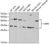 Anti-VAPB antibody used in Western Blot (WB). GTX32958