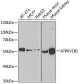 Anti-V-ATPase B1 antibody used in Western Blot (WB). GTX32959