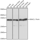 Anti-VDAC1 antibody used in Western Blot (WB). GTX32961