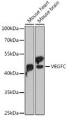 Anti-VEGFC antibody used in Western Blot (WB). GTX32962
