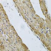 Anti-Vinculin antibody used in IHC (Paraffin sections) (IHC-P). GTX32965
