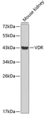 Anti-Vitamin D Receptor antibody used in Western Blot (WB). GTX32967