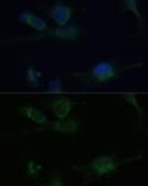 Anti-Von Hippel Lindau antibody used in Immunocytochemistry/ Immunofluorescence (ICC/IF). GTX32968