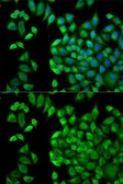 Anti-WNK1 antibody used in Immunocytochemistry/ Immunofluorescence (ICC/IF). GTX32973