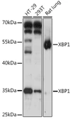 Anti-XBP1 antibody used in Western Blot (WB). GTX32974