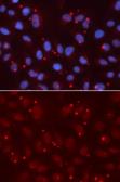 Anti-XRCC3 antibody used in Immunocytochemistry/ Immunofluorescence (ICC/IF). GTX32975