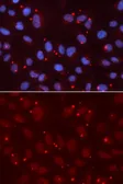 Anti-XRCC3 antibody used in Immunocytochemistry/ Immunofluorescence (ICC/IF). GTX32975