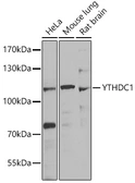 Anti-YTHDC1 antibody used in Western Blot (WB). GTX32976