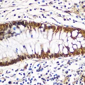 Anti-14-3-3 gamma antibody used in IHC (Paraffin sections) (IHC-P). GTX32982