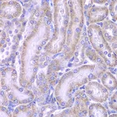 Anti-ACAA1 antibody used in IHC (Paraffin sections) (IHC-P). GTX32986